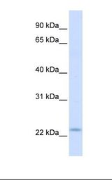 Fetal muscle lysate. Antibody concentration: 1.0 ug/ml. Gel concentration: 12%.