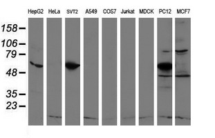 Western blot of extracts (35ug) from 9 different cell lines by using anti-REEP2 monoclonal antibody.