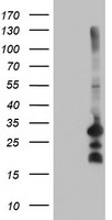 HEK293T cells were transfected with the pCMV6-ENTRY control (Left lane) or pCMV6-ENTRY REEP2 (Right lane) cDNA for 48 hrs and lysed. Equivalent amounts of cell lysates (5 ug per lane) were separated by SDS-PAGE and immunoblotted with anti-REEP2.