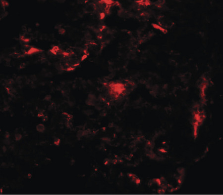 Immunofluorescence of REEP2 in rat lung tissue with REEP2 antibody at 20 ug/ml.