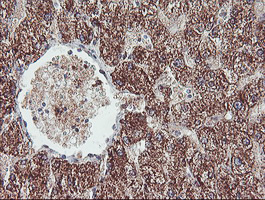 IHC of paraffin-embedded Human liver tissue using anti-REEP2 mouse monoclonal antibody.
