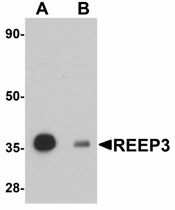 Western blot of REEP3 in rat heart tissue lysate with REEP3 antibody at 1 ug/ml in (A) the absence and (B) the presence of blocking peptide.