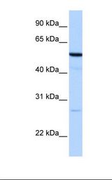 HepG2 cell lysate. Antibody concentration: 1.0 ug/ml. Gel concentration: 12%.
