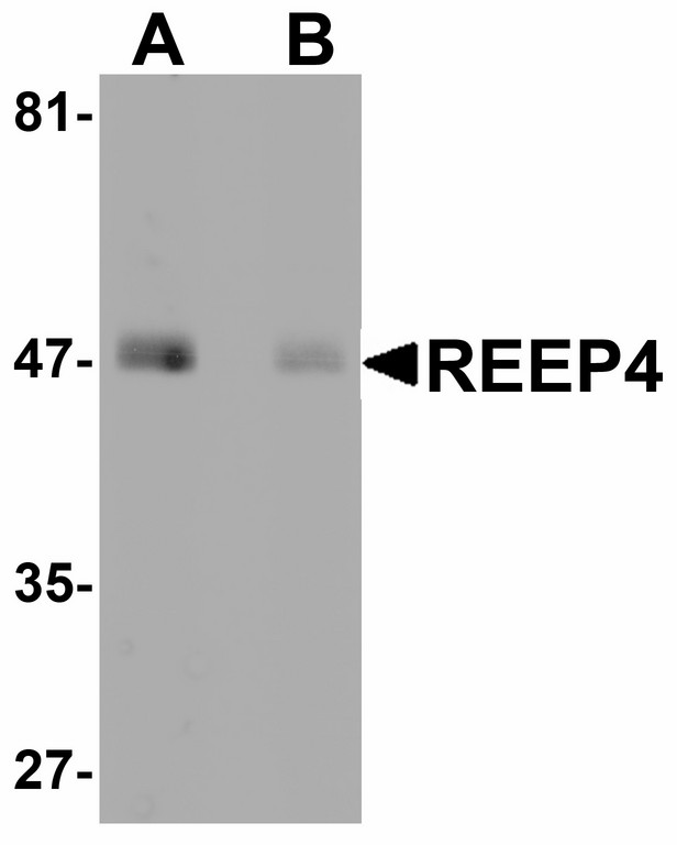 Western blot of REEP4 in human lung tissue lysate with REEP4 antibody at 1 ug/ml in (A) the absence and (B) the presence of blocking peptide.