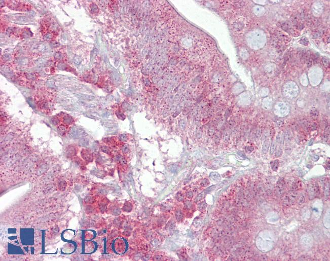 Anti-PSEN1 / Presenilin 1 antibody IHC of human small intestine. Immunohistochemistry of formalin-fixed, paraffin-embedded tissue after heat-induced antigen retrieval. Antibody LS-B6952 concentration 5 ug/ml.