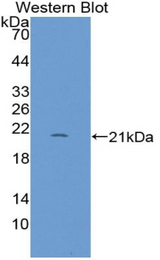 Western blot of recombinant REG1B.