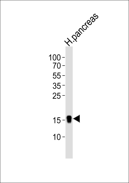 Western blot of lysate from human pancreas tissue lysate with REG3A Antibody. Antibody was diluted at 1:1000. A goat anti-rabbit IgG H&L (HRP) at 1:5000 dilution was used as the secondary antibody. Lysate at 35 ug.