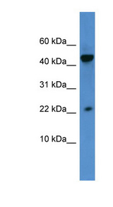 REG3A antibody LS-C135250 Western blot of HeLa lysate.