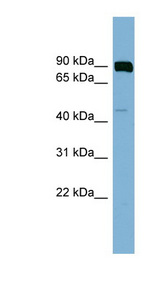 PSEN1 / Presenilin 1 antibody LS-B6832 Western blot of OVCAR-3 cell lysate.