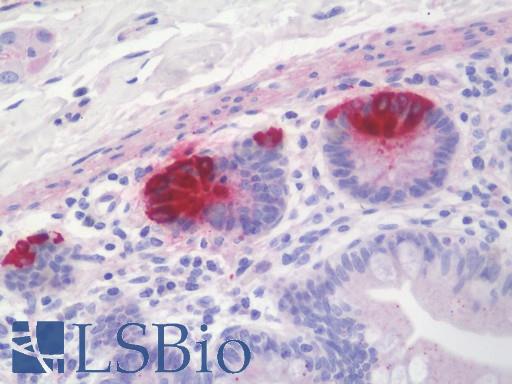 Anti-REG3G antibody IHC staining of human small intestine. Immunohistochemistry of formalin-fixed, paraffin-embedded tissue after heat-induced antigen retrieval. Antibody LS-B10435 dilution 1:100.