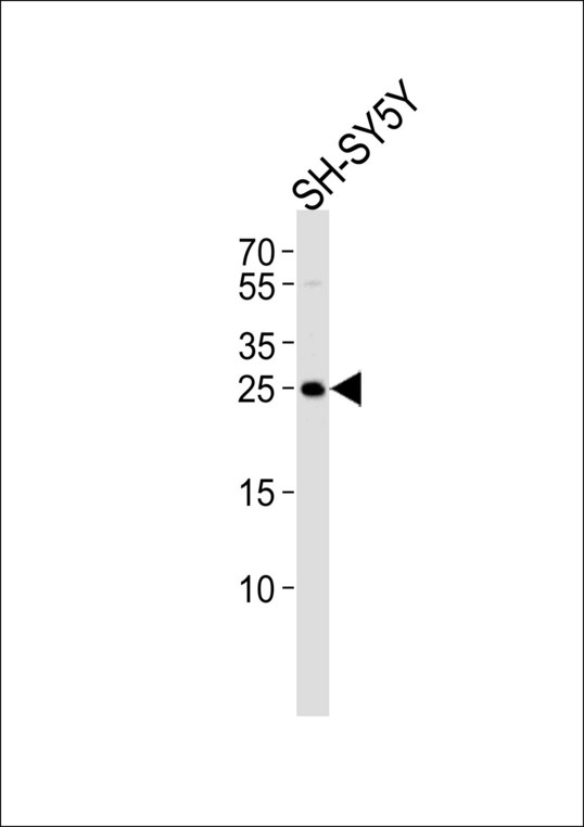 Western blot of lysate from SH-SY5Y cell line, using REG3G Antibody. Antibody was diluted at 1:1000. A goat anti-rabbit IgG H&L (HRP) at 1:5000 dilution was used as the secondary antibody. Lysate at 35ug.
