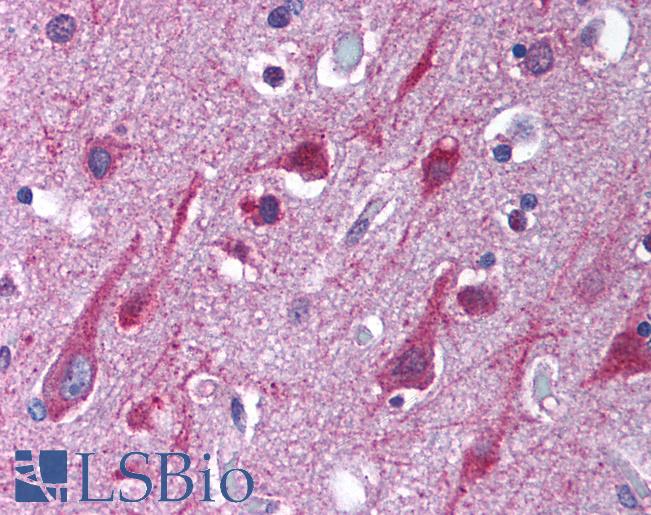 Anti-PSEN1 / Presenilin 1 antibody IHC of human brain, cortex. Immunohistochemistry of formalin-fixed, paraffin-embedded tissue after heat-induced antigen retrieval. Antibody LS-B1390 concentration 5 ug/ml.