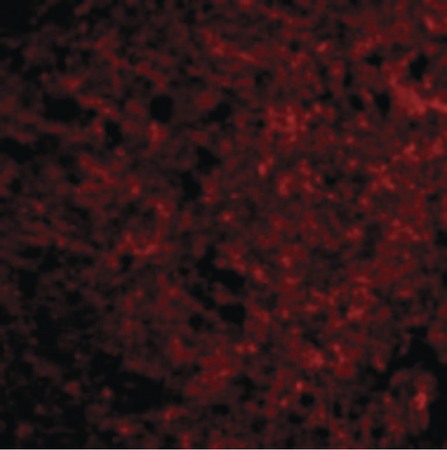 Immunofluorescence of Presenilin1 in Human Brain cells with Presenilin1 antibody at 20 ug/ml.