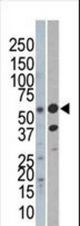 Western blot of anti-C-rel (NFkB) antibody in Jurkat (left) and mouse kidney (right) cell line lysate. C-rel (NFkB)(arrow) was detected using the purified antibody.