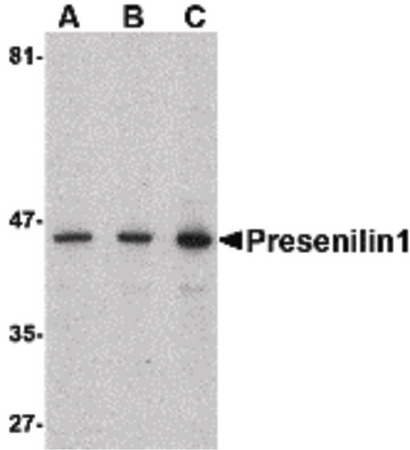 Western blot of presenilin1 in human brain lysate with presenilin1 antibody at (A) 0.5, (B) 1, and (C) 2 ug/ml.