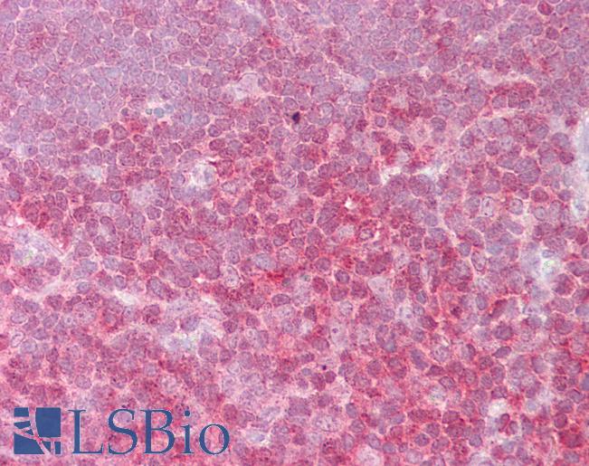 Anti-c-Rel antibody IHC of human thymus. Immunohistochemistry of formalin-fixed, paraffin-embedded tissue after heat-induced antigen retrieval. Antibody LS-B6495 concentration 2.5 ug/ml.