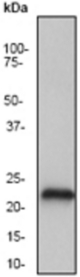 Western blot analysis on PC-12 cell lysate using anti- Presenilin 2 antibody, dilution 1:200000.