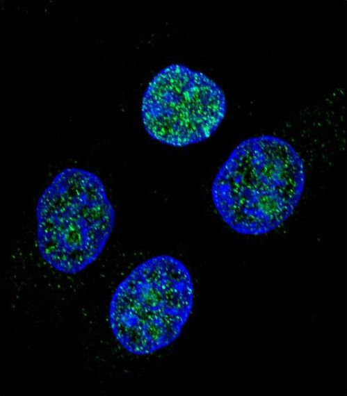 Confocal immunofluorescent of PROC Antibody with HeLa cell followed by Alexa Fluor 488-conjugated goat anti-rabbit lgG (green). DAPI was used to stain the cell nuclear (blue).