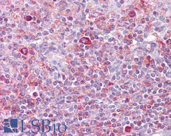 Anti-RELB antibody IHC of human spleen. Immunohistochemistry of formalin-fixed, paraffin-embedded tissue after heat-induced antigen retrieval. Antibody LS-B6620 concentration 5 ug/ml.