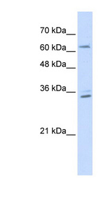 RELB antibody LS-C110325 Western blot of Transfected 293T cell lysate.