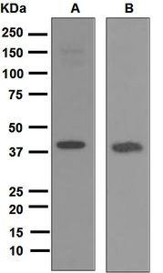 Western blot analysis on (A) C2C12 and (B) SW1353 cell lysates using anti-REM antibody.