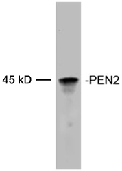 Western blot of recombinant Human PEN2 protein. Primary antibody: 2 ug/ml Rabbit Anti-PEN2 Polyclonal Antibody. The signal was developed with IRDye 800 Conjugated Goat Anti-Rabbit IgG.