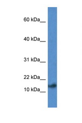 PSENEN / PEN2 antibody LS-C145247 Western blot of Mouse Heart lysate. Antibody concentration 1 ug/ml.