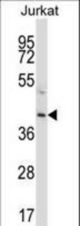 PROC Antibody western blot of Jurkat cell line lysates (35 ug/lane). The PROC antibody detected the PROC protein (arrow).