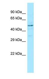 RENBP antibody Western Blot of 721_B.