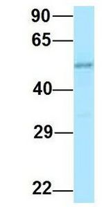RENBP antibody Western Blot of Human Placenta. Antibody Dilution: 1.0 ug/ml. Antibody dilution: 1 ug/ml.