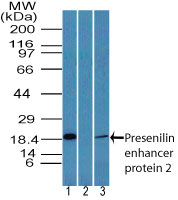 Western blot of Presenilin enhancer protein 2 in human intestine lysate in the 1) absence and 2) presence of immunizing peptide and 3) mouse intestine lysate using LS-C148699 at 3 and 7 ug/ml, respectively. Goat anti-rabbit Ig HRP secondary antibody, and PicoTect ECL substrate solution, were used for this test.
