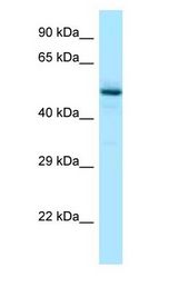 RENBP antibody Western Blot of Fetal Liver.
