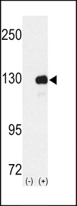 Western blot of RENT1 (arrow) using rabbit polyclonal RENT1 Antibody. 293 cell lysates (2 ug/lane) either nontransfected (Lane 1) or transiently transfected with the RENT1 gene (Lane 2) (Origene Technologies).