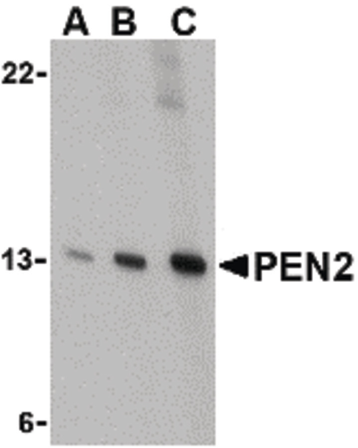 Western blot of PEN2 in K562 cell lysate with PEN2 antibody at (A) 0.5, (B) 1, and (C) 2 ug/ml.