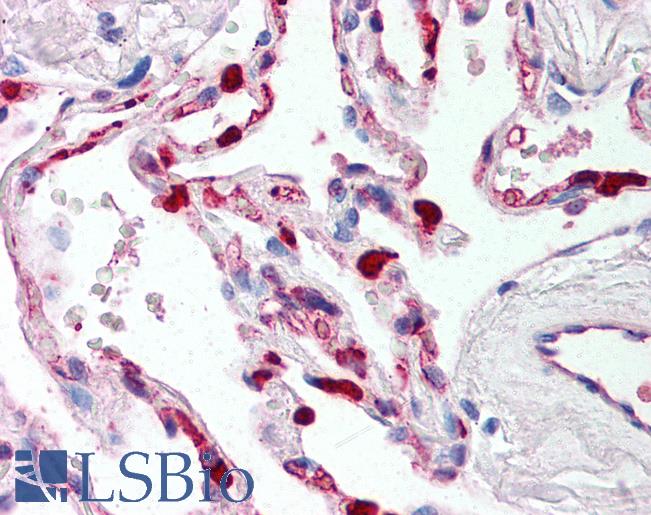 Anti-PEN2 antibody IHC of human lung. Immunohistochemistry of formalin-fixed, paraffin-embedded tissue after heat-induced antigen retrieval. Antibody LS-B299 dilution 1:500.