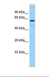 Western blot of Human 721_B. REPS2 antibody dilution 1.0 ug/ml.