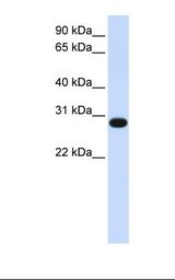 Fetal muscle lysate. Antibody concentration: 1.0 ug/ml. Gel concentration: 12%.