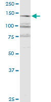 RERE monoclonal antibody (M06), clone 2F2. Western Blot analysis of RERE expression in Jurkat.
