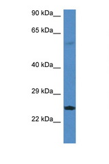 RERG antibody LS-C145295 Western blot of Rat Lung lysate. Antibody concentration 1 ug/ml.