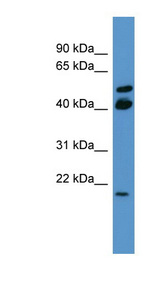RERG antibody LS-C135584 Western blot of COLO205 cell lysate.