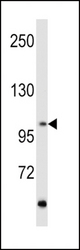 Western blot of hRET-G28 in MCF7 cell line lysates (35 ug/lane). RET (arrow) was detected using the purified antibody.