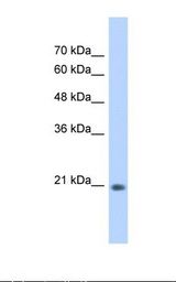 HepG2 cell lysate. Antibody concentration: 0.25 ug/ml. Gel concentration: 12%.