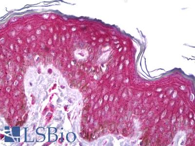 Anti-RET antibody IHC of human skin. Immunohistochemistry of formalin-fixed, paraffin-embedded tissue after heat-induced antigen retrieval. Antibody LS-B6584 concentration 5 ug/ml.