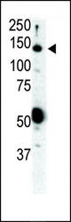 Western blot of anti-Ret antibody in SKBR3 cell lysate. Ret (arrow) was detected using purified antibody. Secondary HRP-anti-rabbit was used for signal visualization with chemiluminescence.