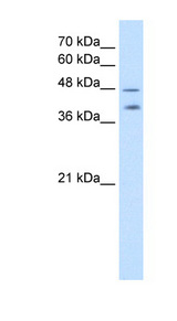 PSG1 antibody LS-C40379 Western blot of NCI-H226 cell lysate.