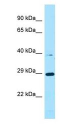 PROCA1 antibody Western Blot of ACHN.