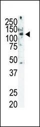 Western blot of Ret Antibody (C-term T1078) in SKBR3 cell lysate. Ret (arrow) was detected using purified antibody. Secondary HRP-anti-rabbit was used for signal visualization with chemiluminescence.