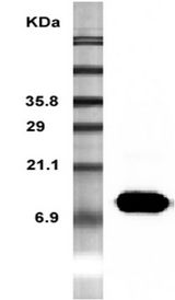Western Blot analysis of recombinant resistin using anti-Resistin (mouse), mAb (MRES 06) at 1:5000 dilution.