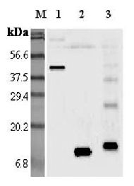 Western blot analysis using anti-Resistin (mouse), pAb at 1:5000 dilution. 1: Mouse Resistin Fc-protein. 2: Mouse Resistin. 3: Mouse Resistin (His-tagged).