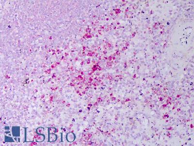 Anti-RETN / Resistin antibody IHC of human spleen. Immunohistochemistry of formalin-fixed, paraffin-embedded tissue after heat-induced antigen retrieval. Antibody LS-B7412 concentration 10 ug/ml.